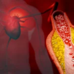 Millions may be getting the wrong cholesterol test